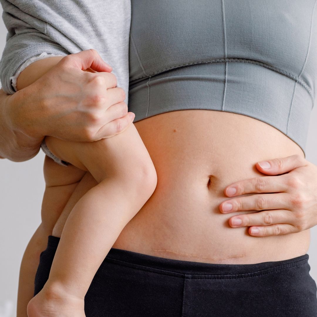 The Ultimate Post-Partum Recovery Guide: Reclaiming Your Strength
